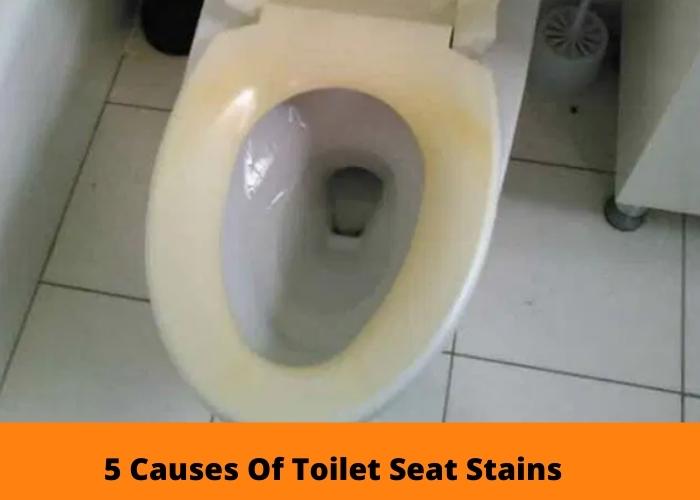 Causes Of Toilet Seat Stains