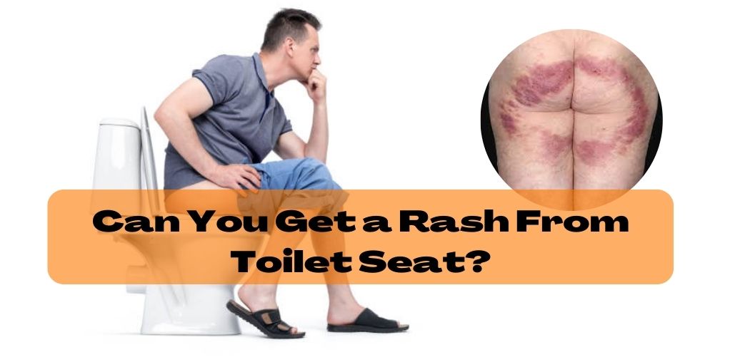 Can You Get a Rash From Toilet Seat?